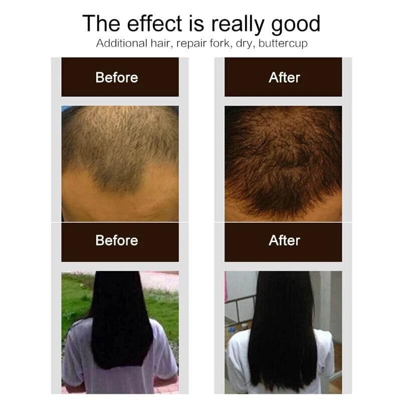 Hair Growth Spray Essence for Daily Hydration and Radiant Skin Smooths Fine Lines Ideal for All Skin Types by eprolo