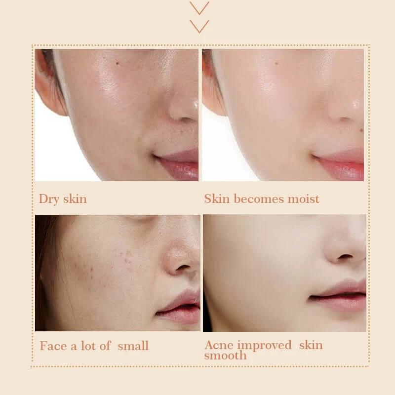 Snail Essence Face Cream Hydrating Cream For Aging Skin Plumps Fine Lines Radiant Glow Daily Use by eprolo