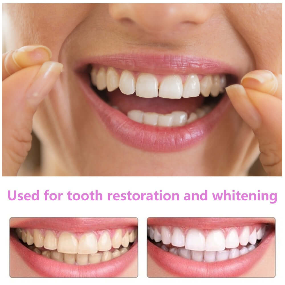Simulation braces smile whitening