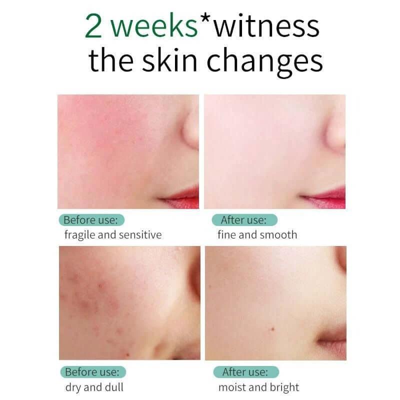 Skin Ever Centella Repair Face Cream Strengthens Skin Barrier Hydrates Dry Mature Skin by eprolo